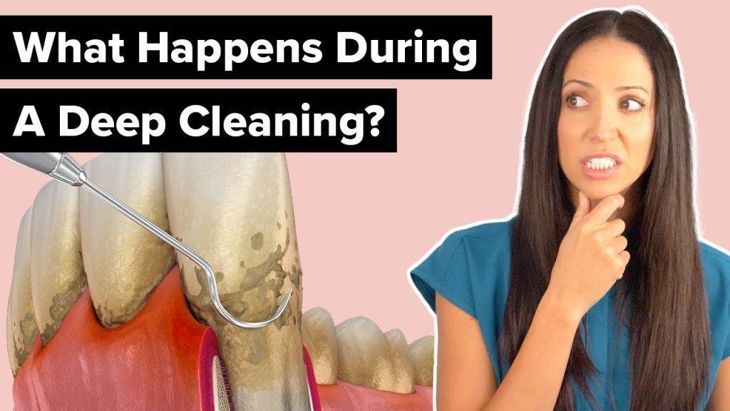 What Is Done During A Deep Cleaning?
